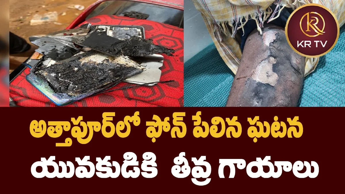 అత్తాపూర్లో ఫోన్ పేలిన ఘటన – యువకుడికి తీవ్ర గాయాలు